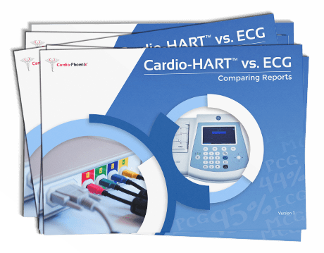 Cardio-HART vs. ECG