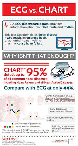 ECG vs. CHART ECG vs. CHART
