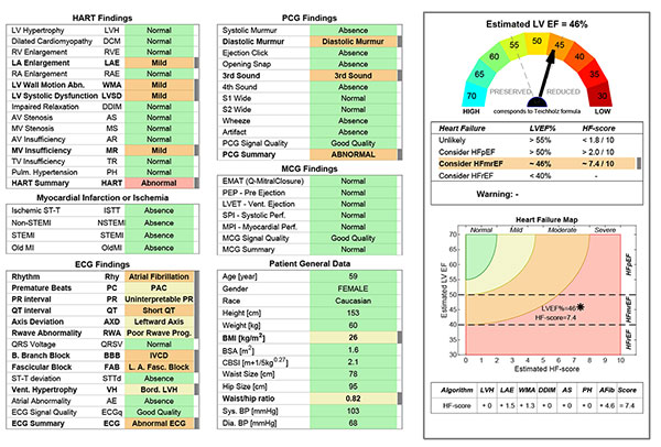 Cardio -HART report