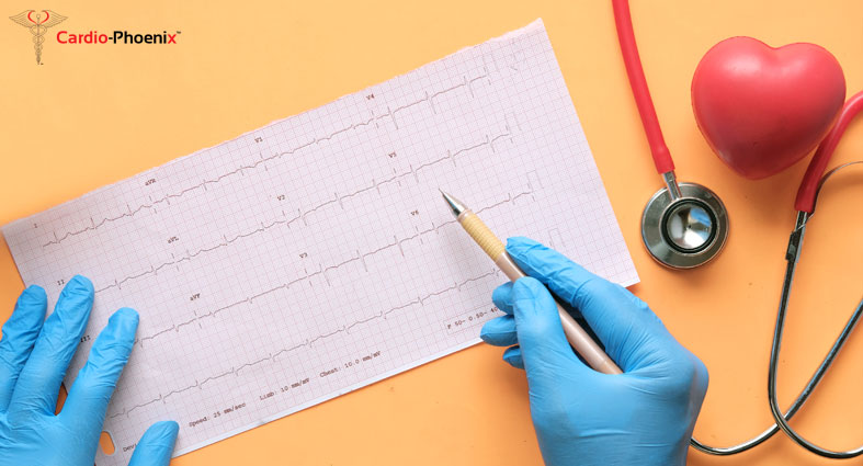 An Inconclusive ECG An Inconclusive ECG