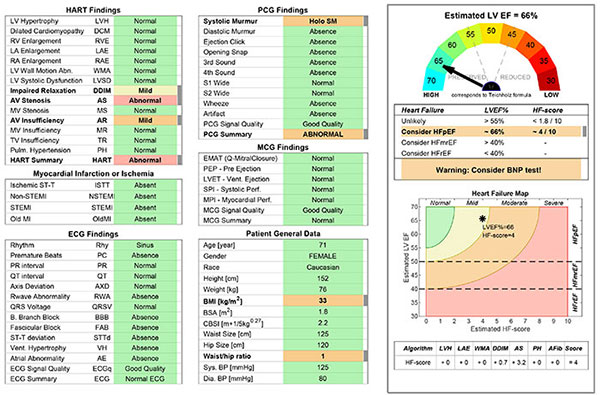 Aortic stenosis Hart findings, PCG, MCH, HF