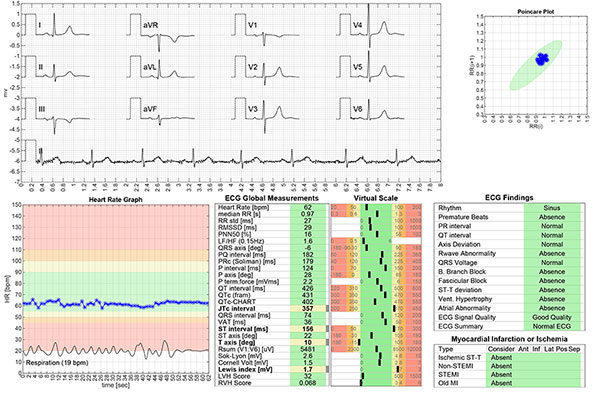 Aortic stenosis