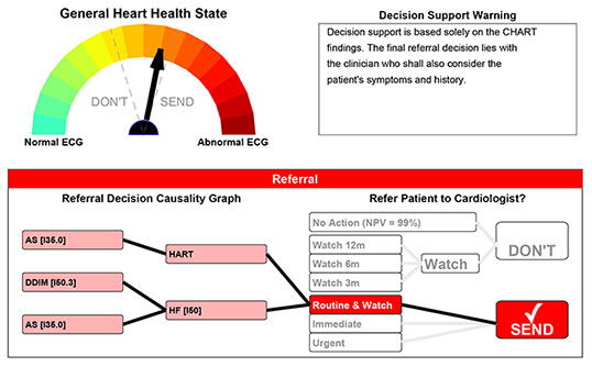 Decision support