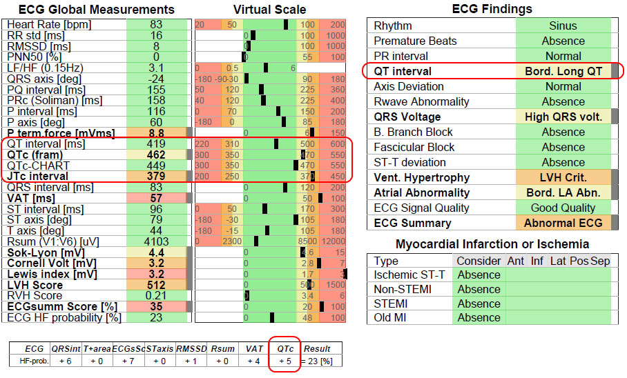 Example of Borderline Long QT interval