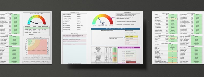 Chart Report