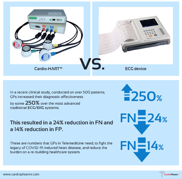 Chart vs ECG