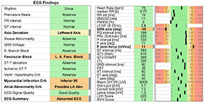 ECG Findings