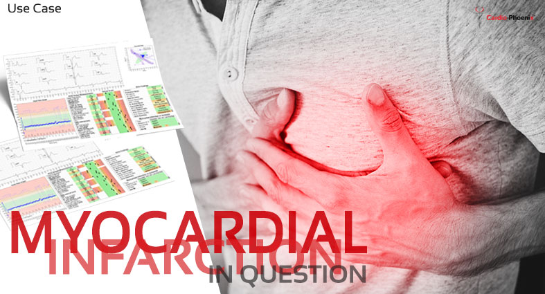 Myocardial infarction in question