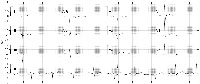 ECG Findings