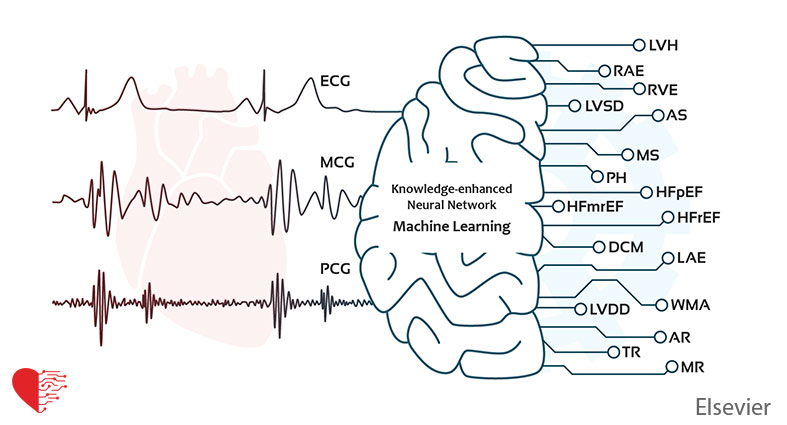 Detecting heart failure using novel bio-signals and a knowledge enhanced neural network
