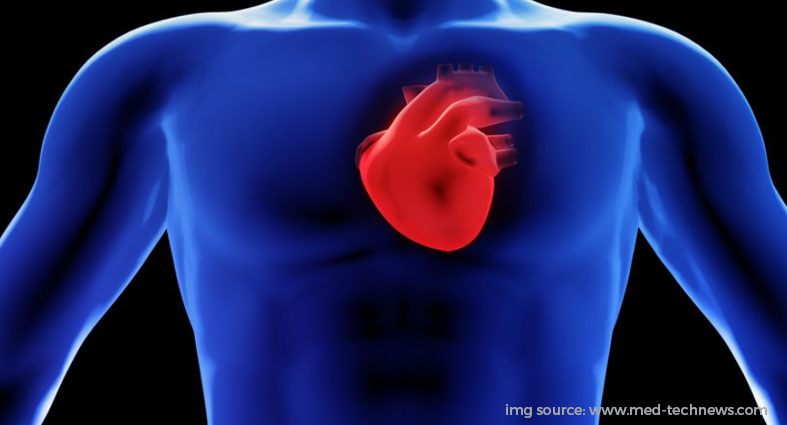 Q&A: Technology aiming to improve detection of heart disease