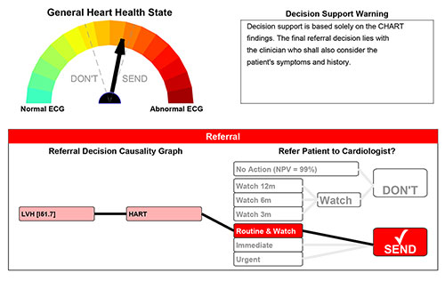 Decision - chart report