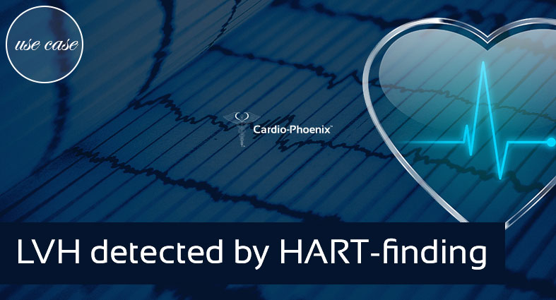 ECG shows false negative LVH, but LVH detected by HART-finding