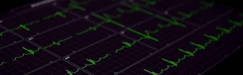 Cardio-HART™ - a Breakthrough Cardiac-Telemedicine™ device, now CE-Marked 